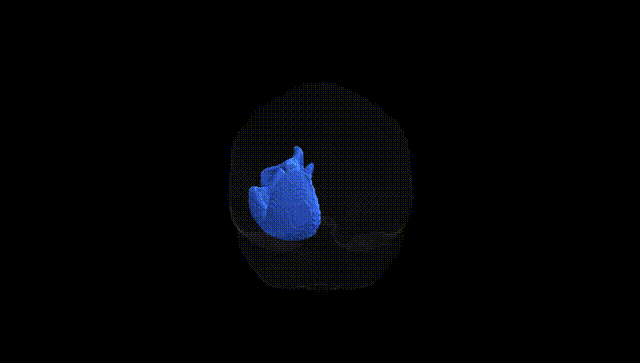 Full Brain Black