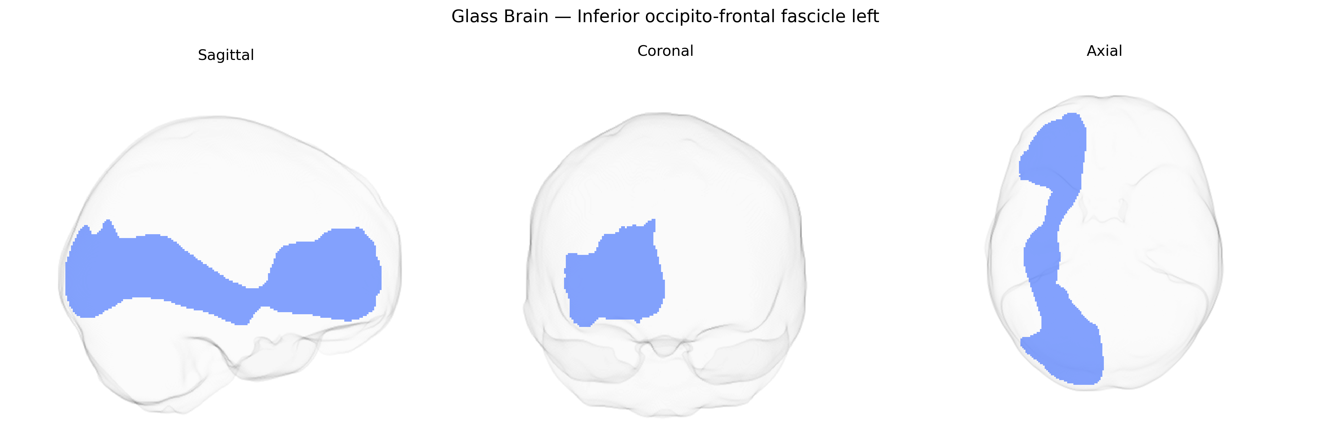 Triplanar Ghost Brain