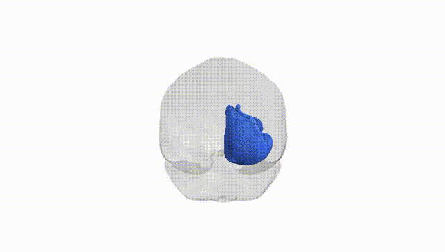 Full Brain White