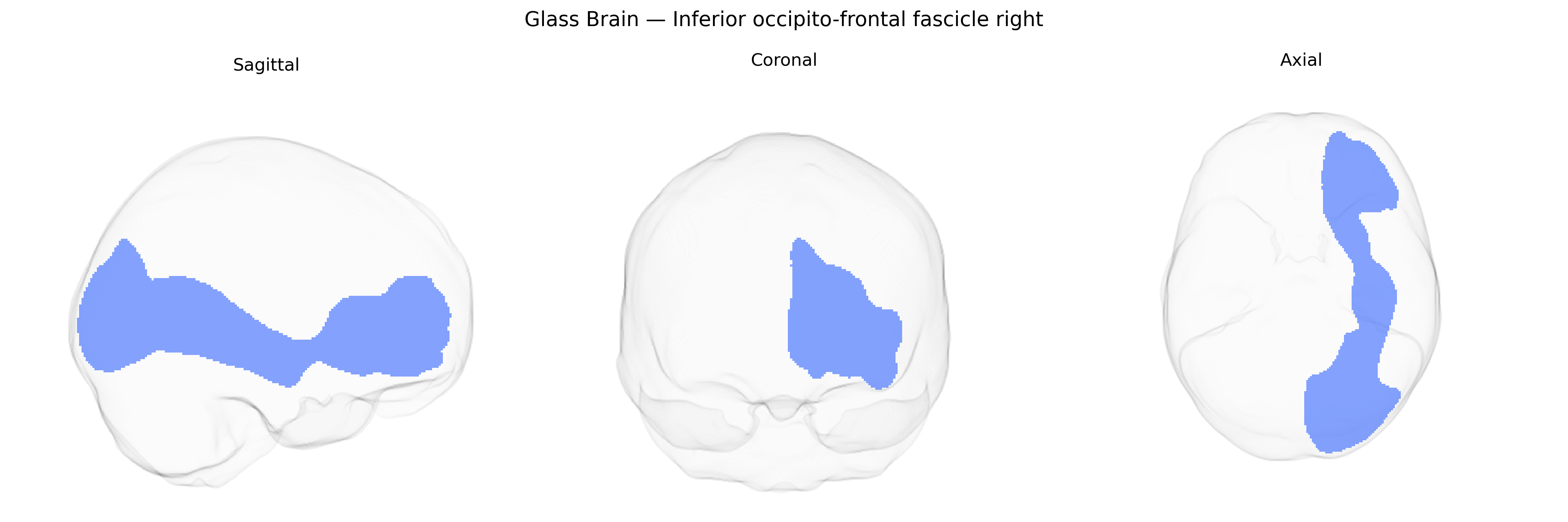 Triplanar Ghost Brain