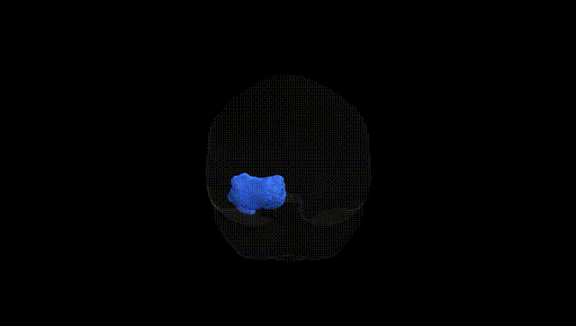 Full Brain Black