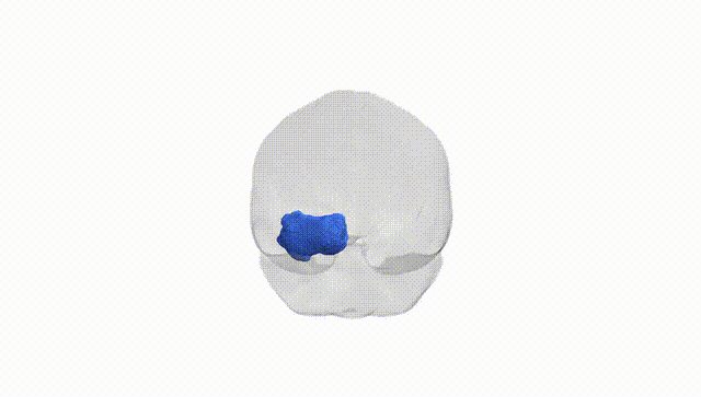 Full Brain White