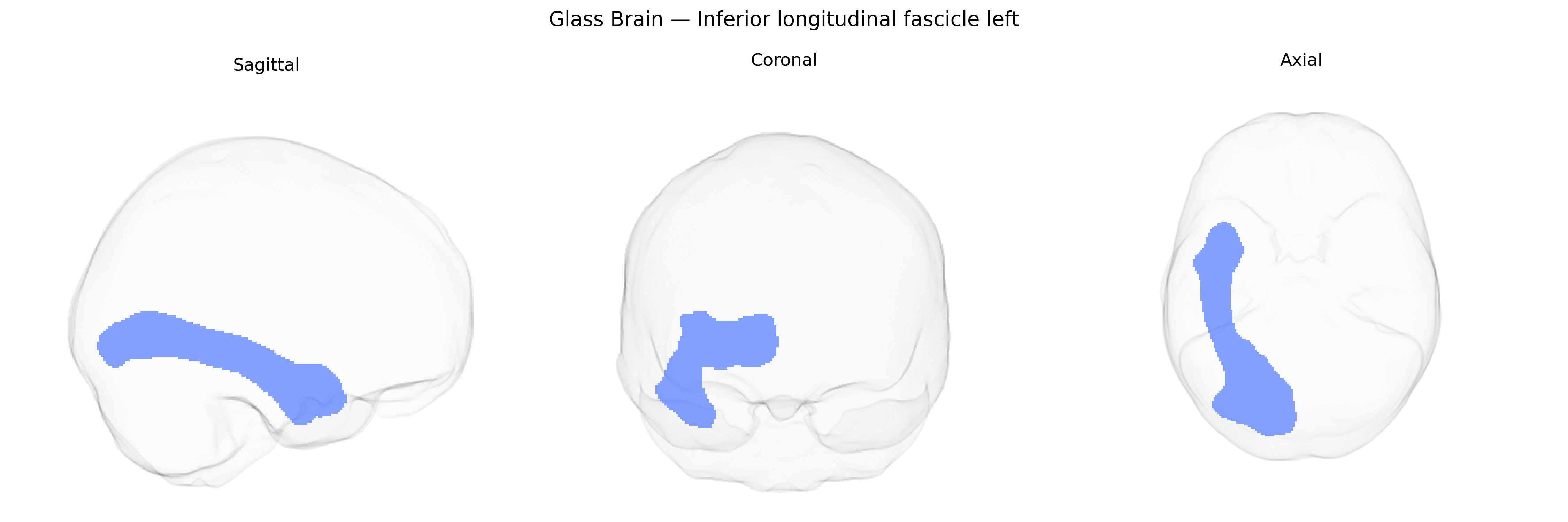 Triplanar Ghost Brain
