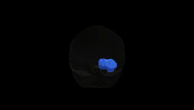 Full Brain Black