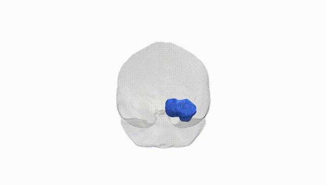 Full Brain White