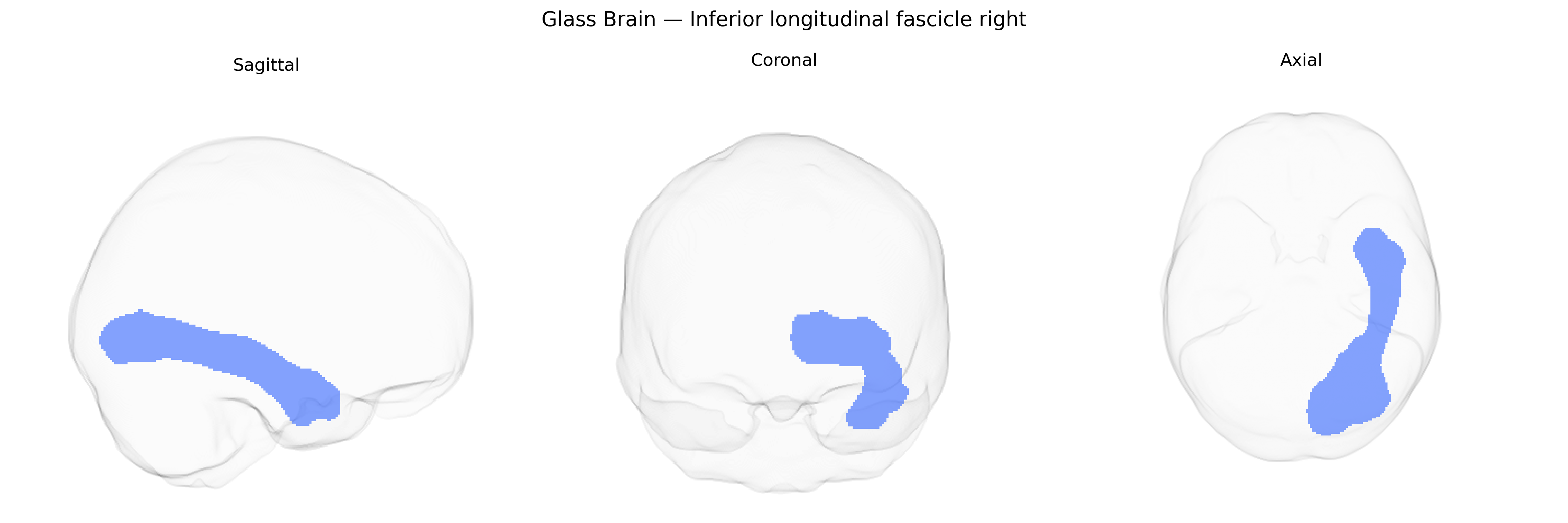 Triplanar Ghost Brain