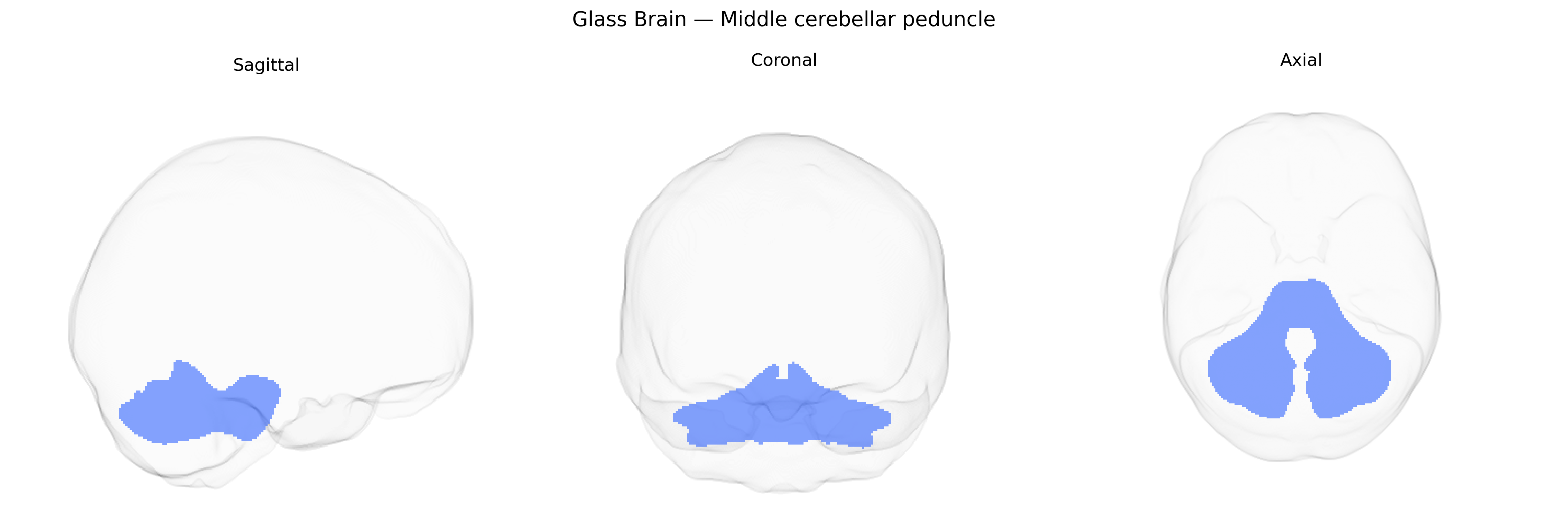 Triplanar Ghost Brain