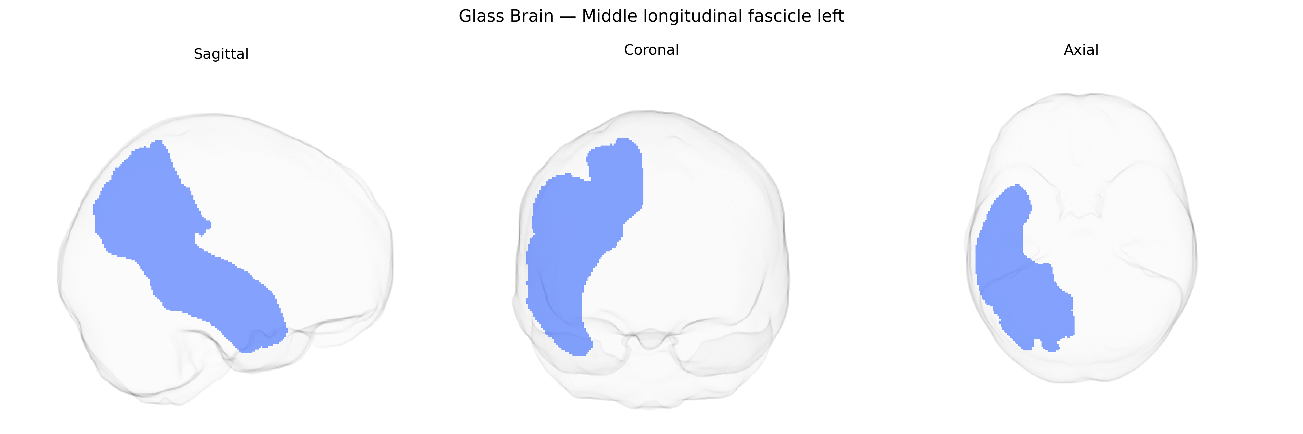 Triplanar Ghost Brain