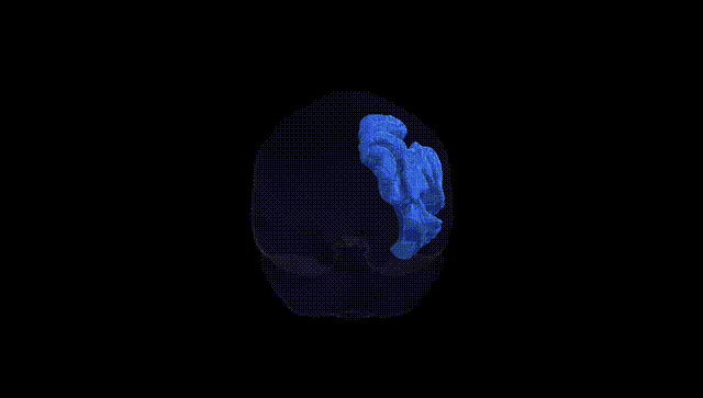 Full Brain Black