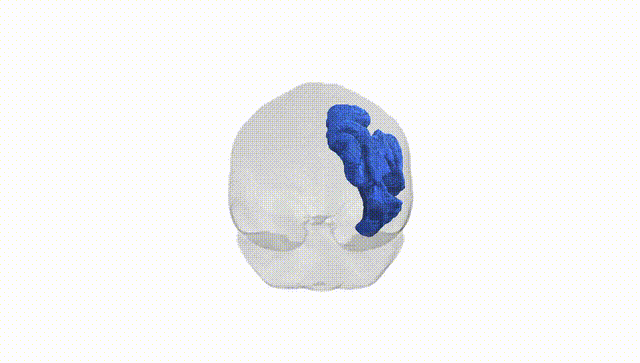 Full Brain White