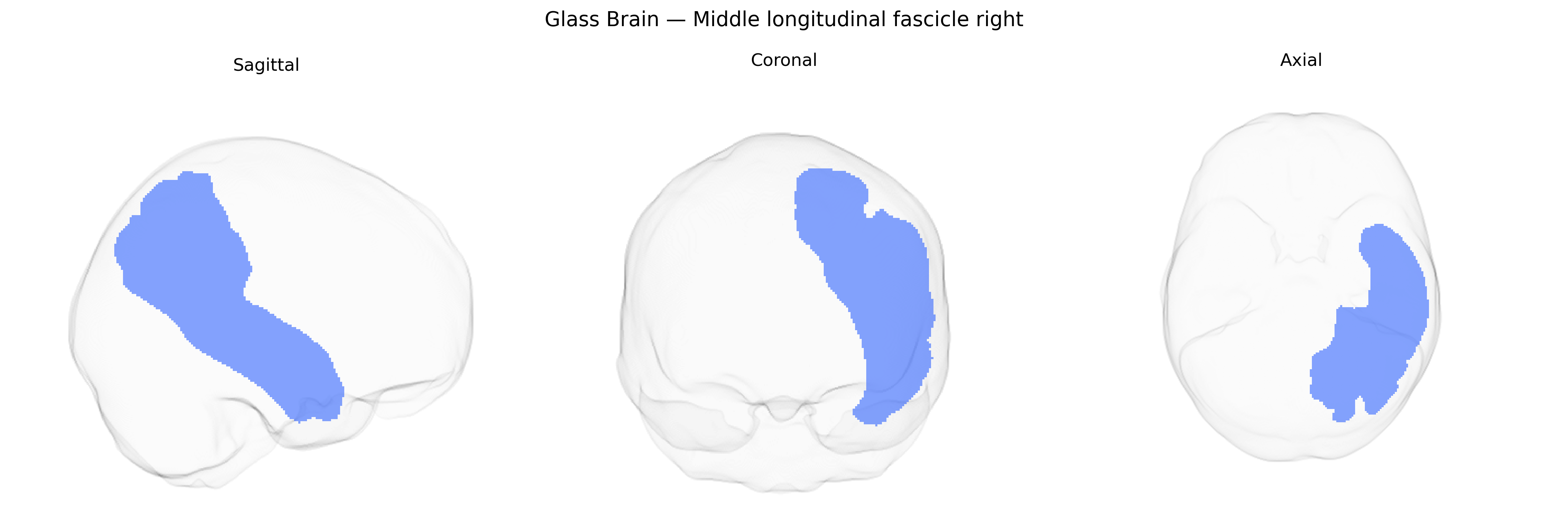 Triplanar Ghost Brain