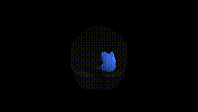 Full Brain Black