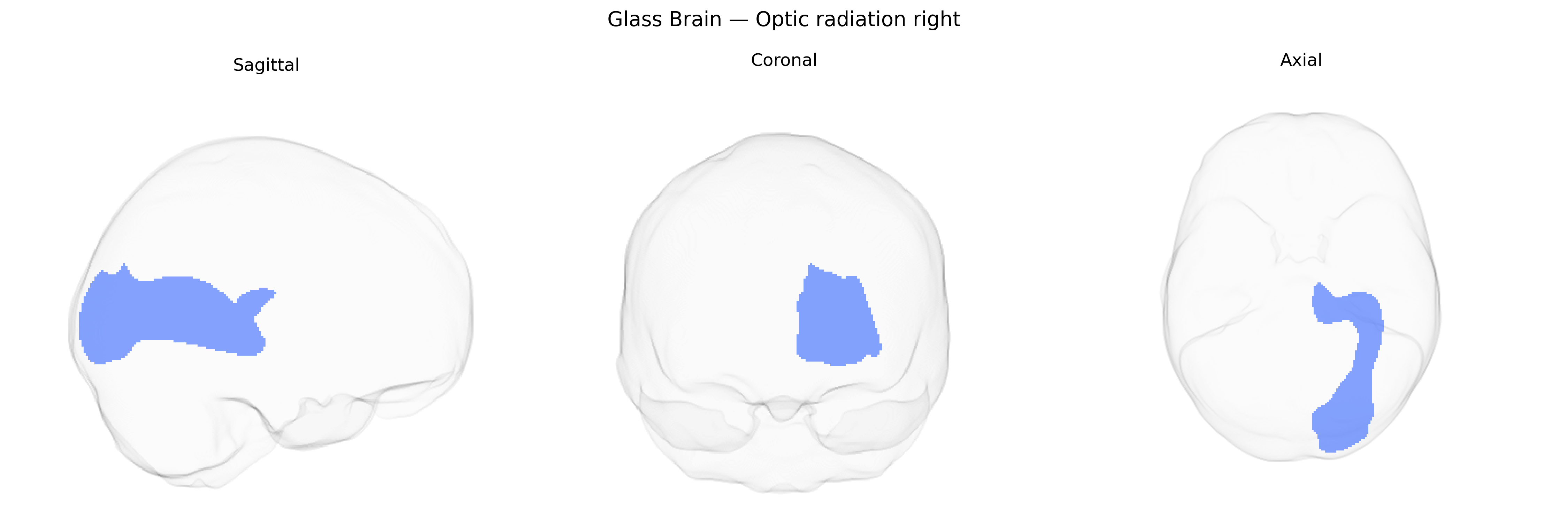 Triplanar Ghost Brain
