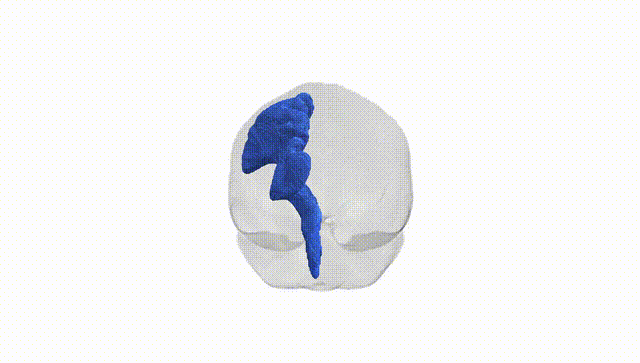 Full Brain White