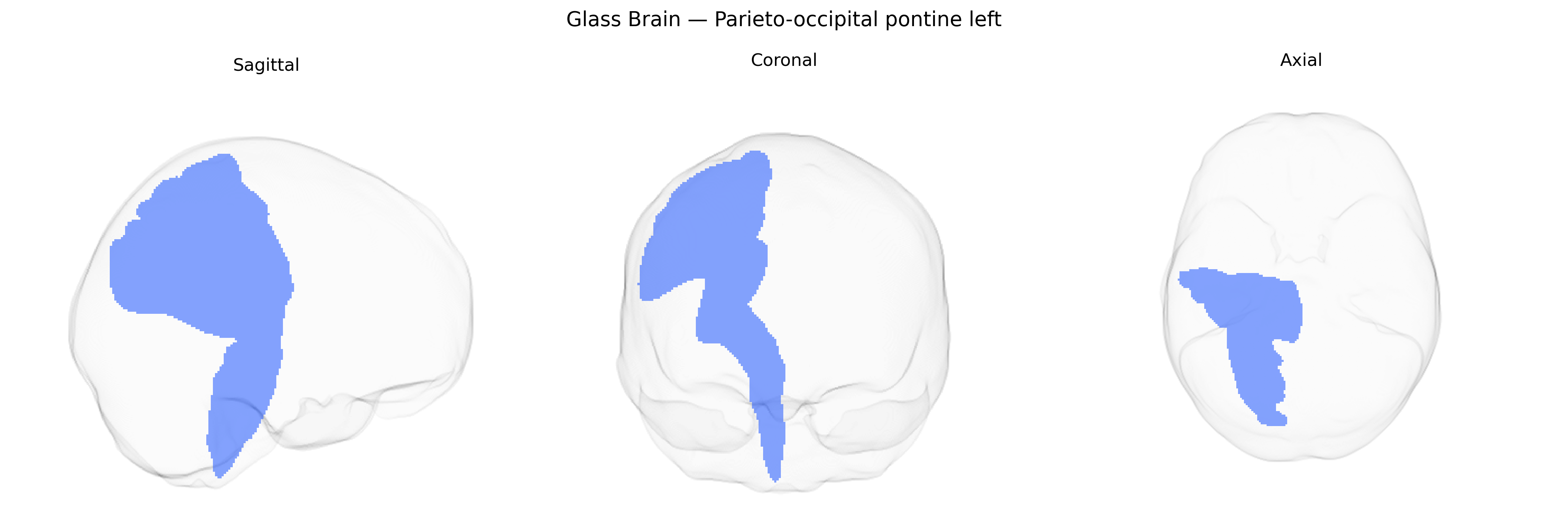 Triplanar Ghost Brain
