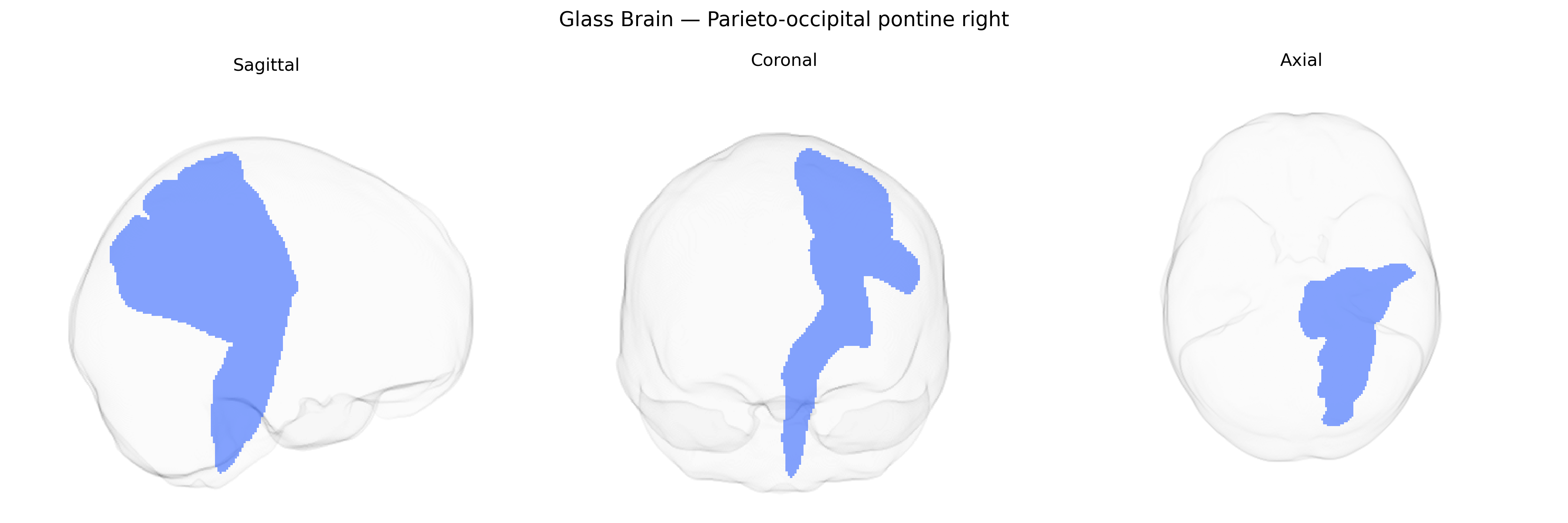 Triplanar Ghost Brain