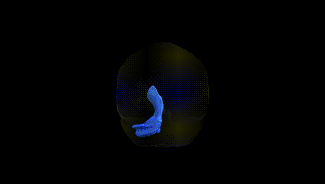 Full Brain Black