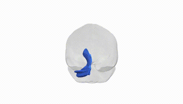Full Brain White