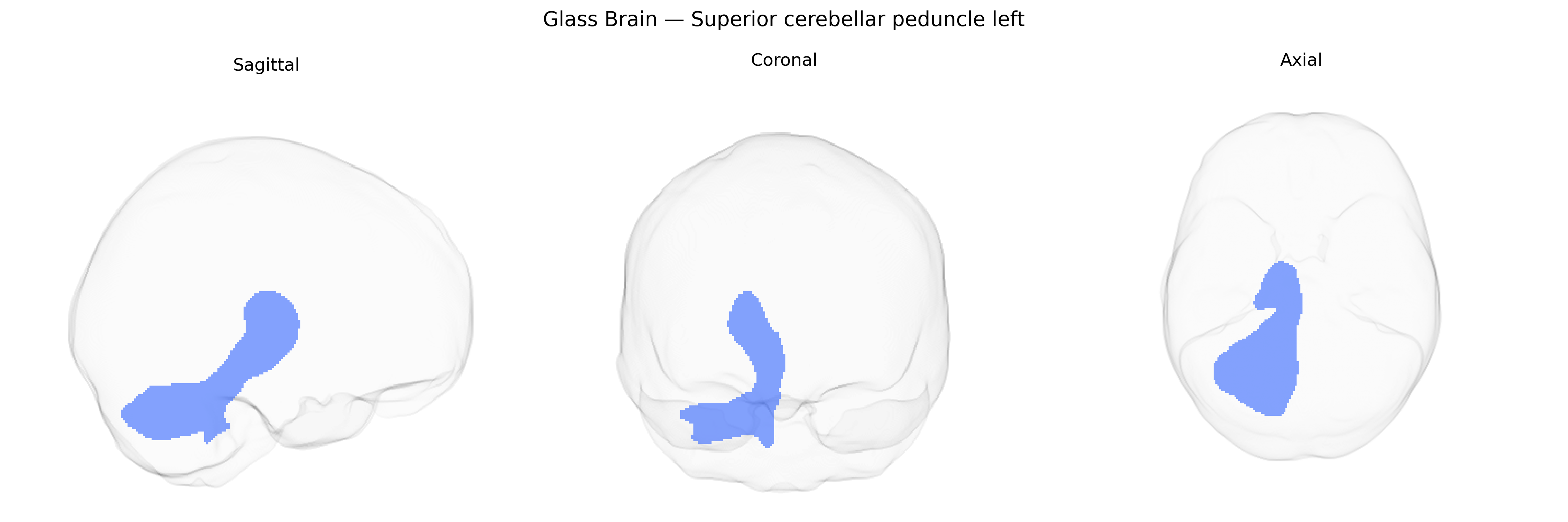Triplanar Ghost Brain