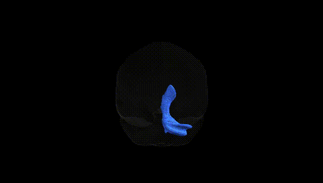 Full Brain Black