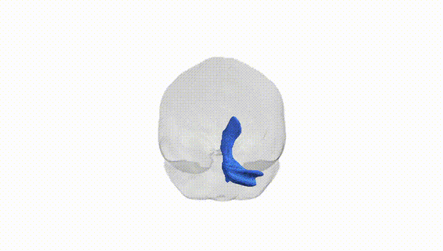 Full Brain White