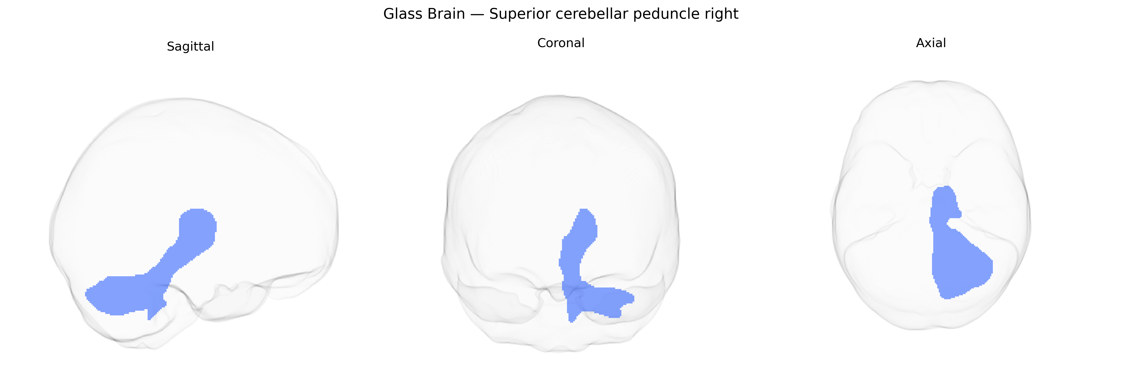 Triplanar Ghost Brain