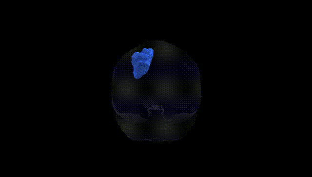Full Brain Black