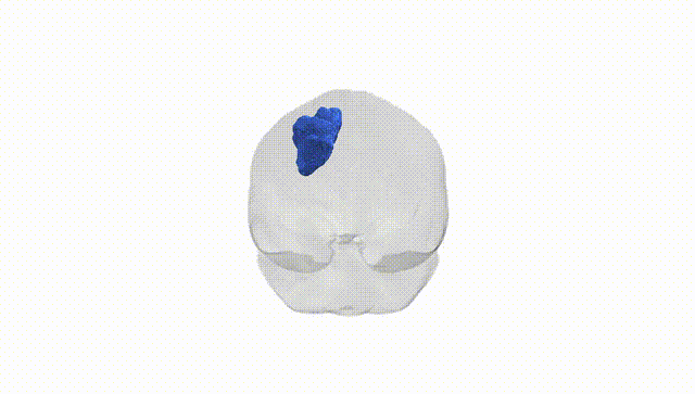 Full Brain White