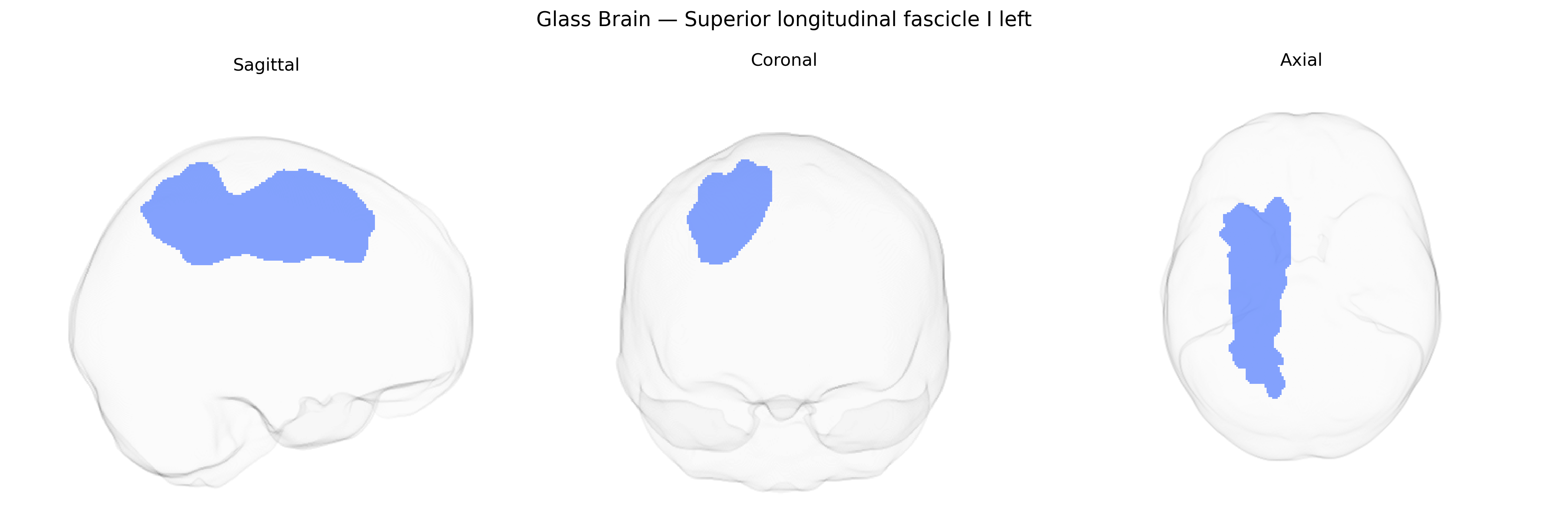 Triplanar Ghost Brain