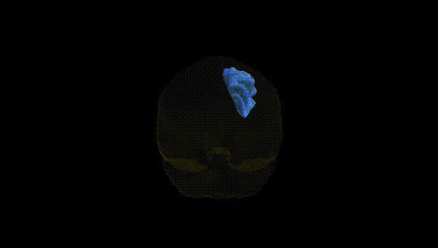 Full Brain Black