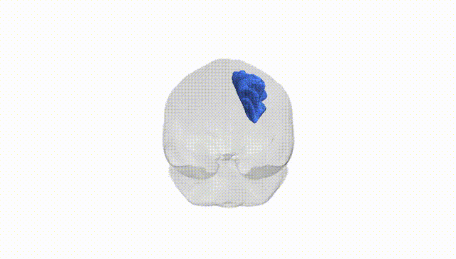 Full Brain White