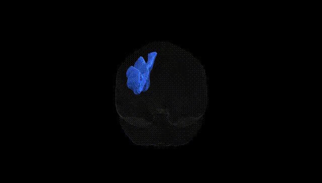 Full Brain Black