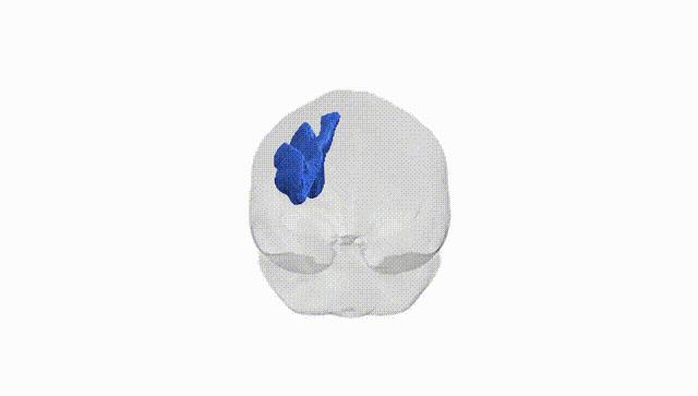 Full Brain White