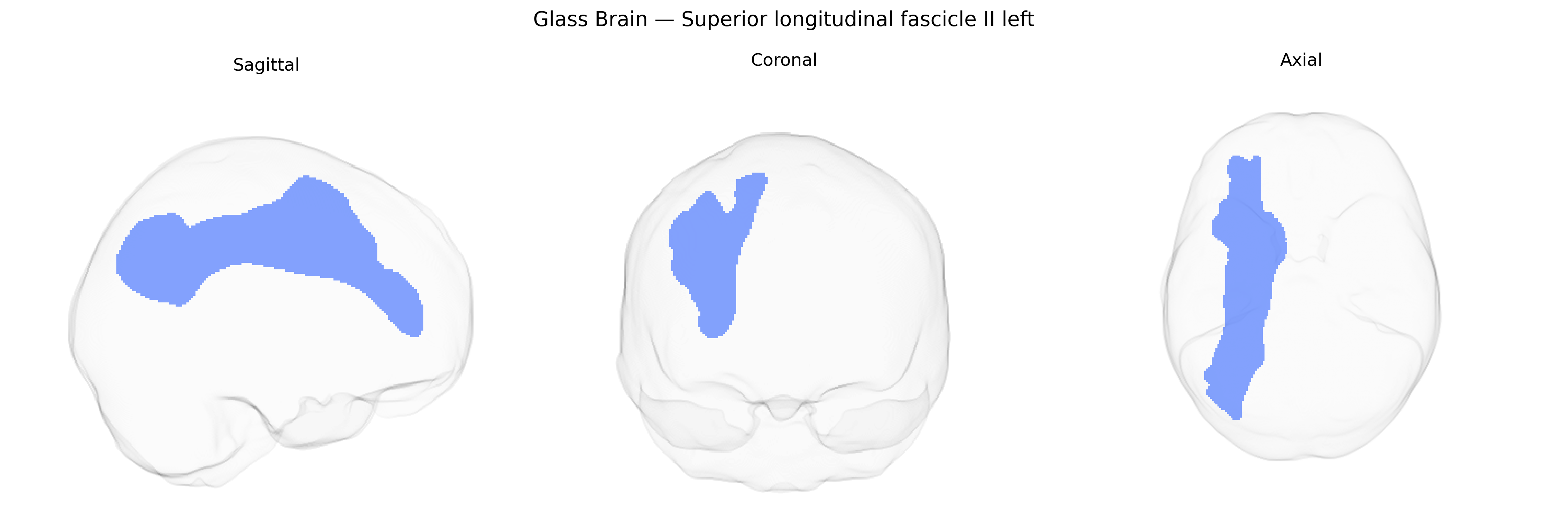 Triplanar Ghost Brain