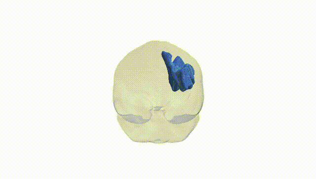 Full Brain White