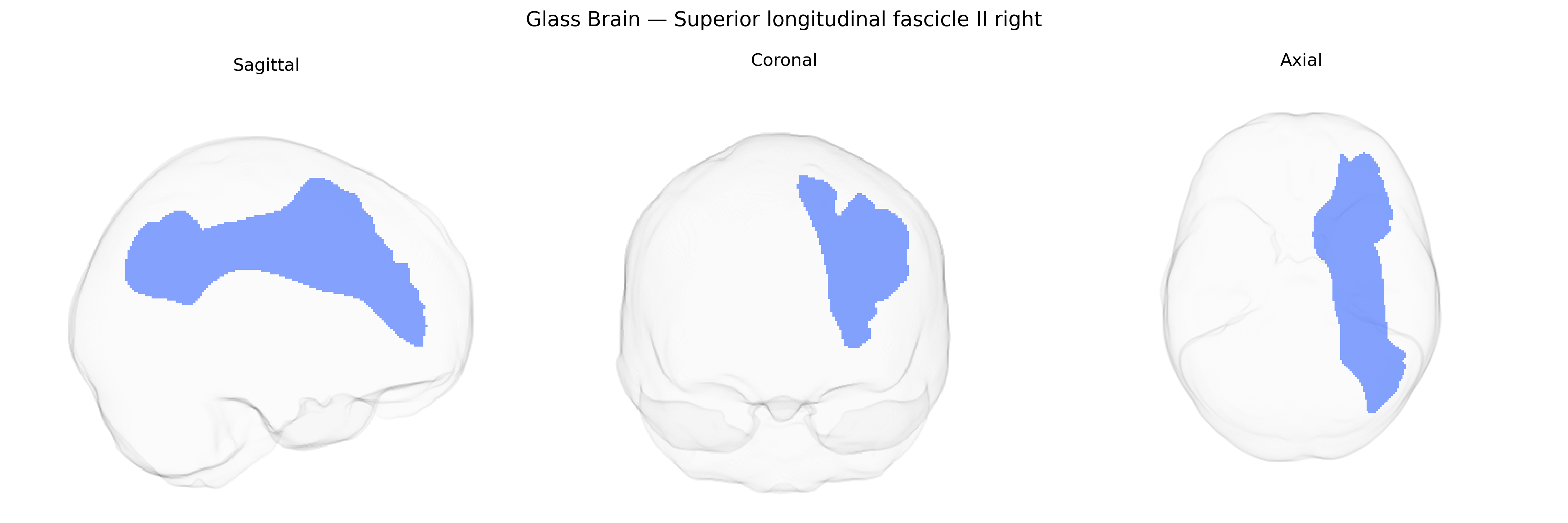 Triplanar Ghost Brain