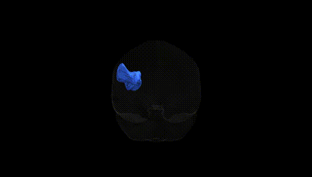 Full Brain Black