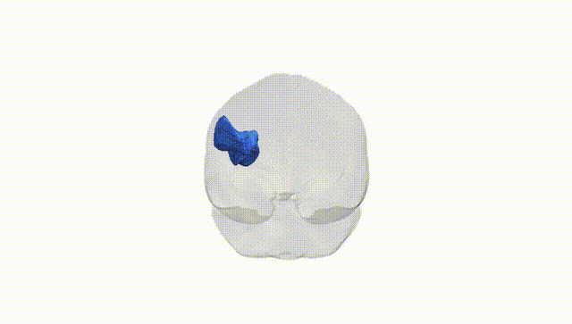 Full Brain White