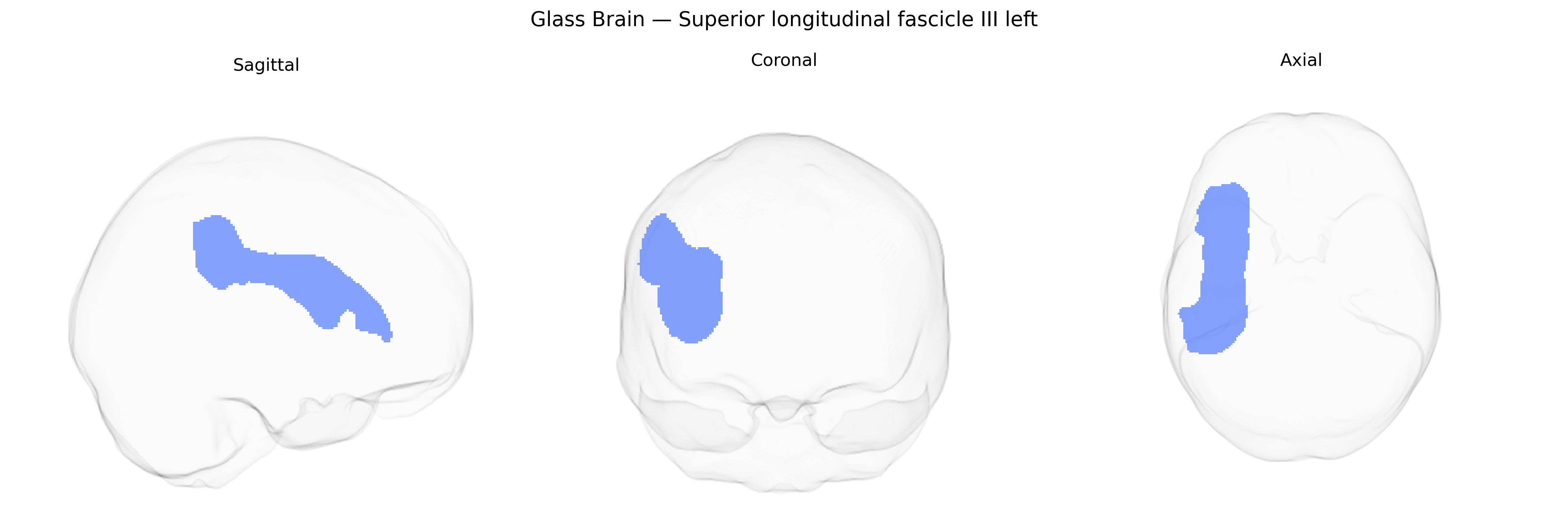 Triplanar Ghost Brain