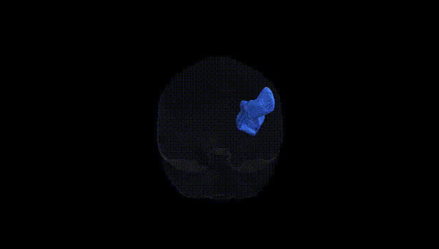 Full Brain Black