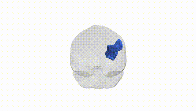 Full Brain White