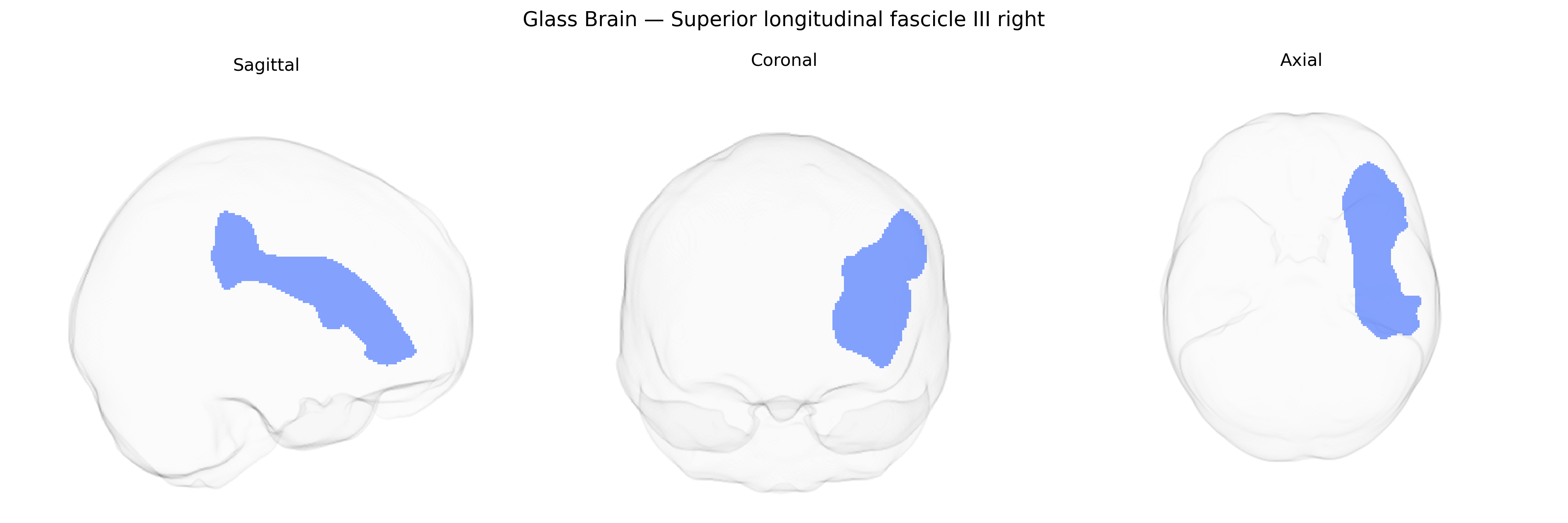 Triplanar Ghost Brain