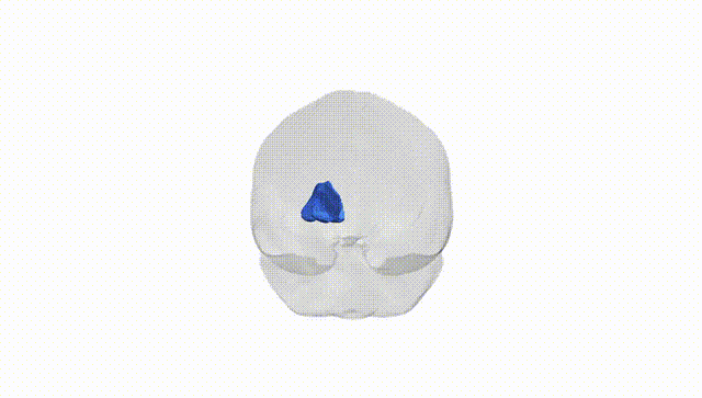 Full Brain White