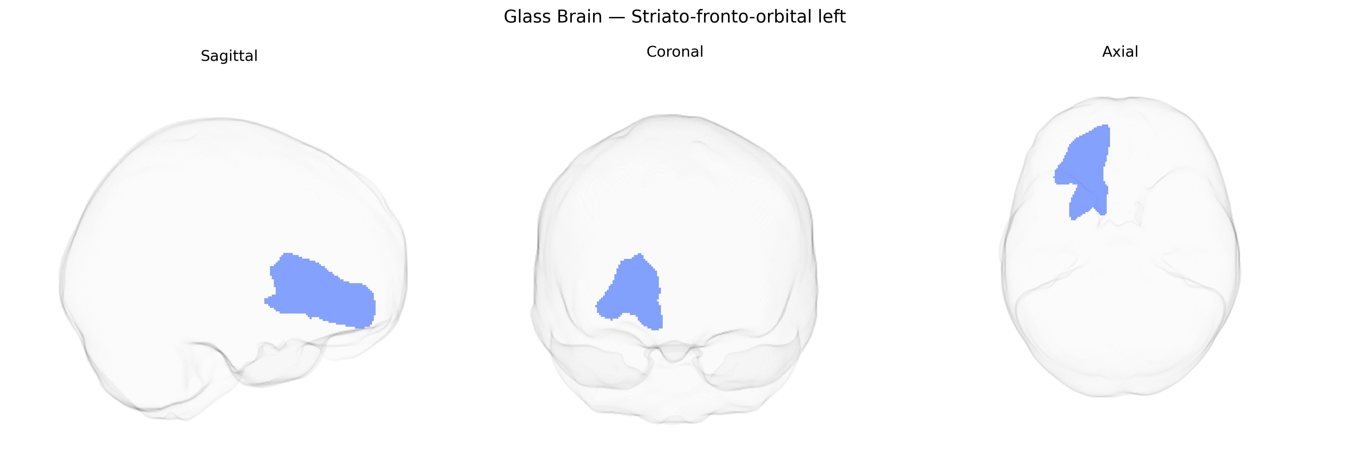 Triplanar Ghost Brain
