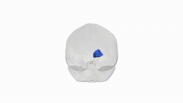 Full Brain White