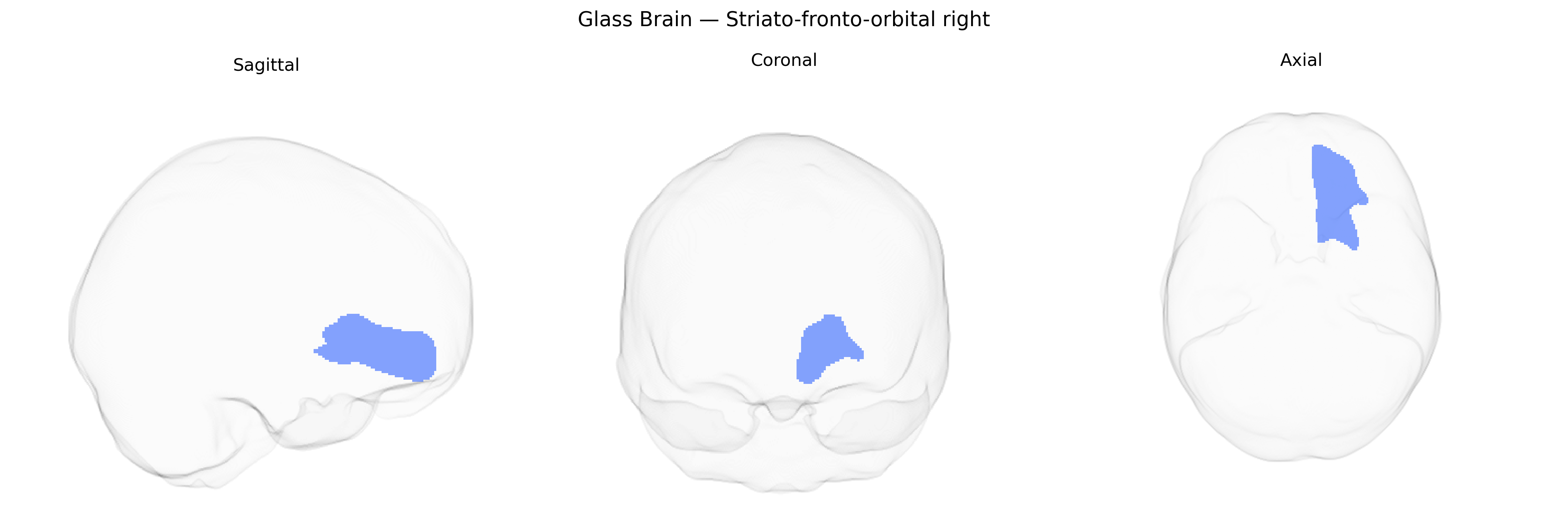 Triplanar Ghost Brain
