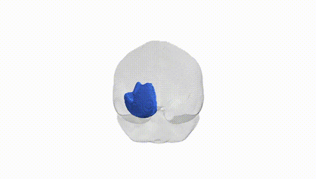 Full Brain White
