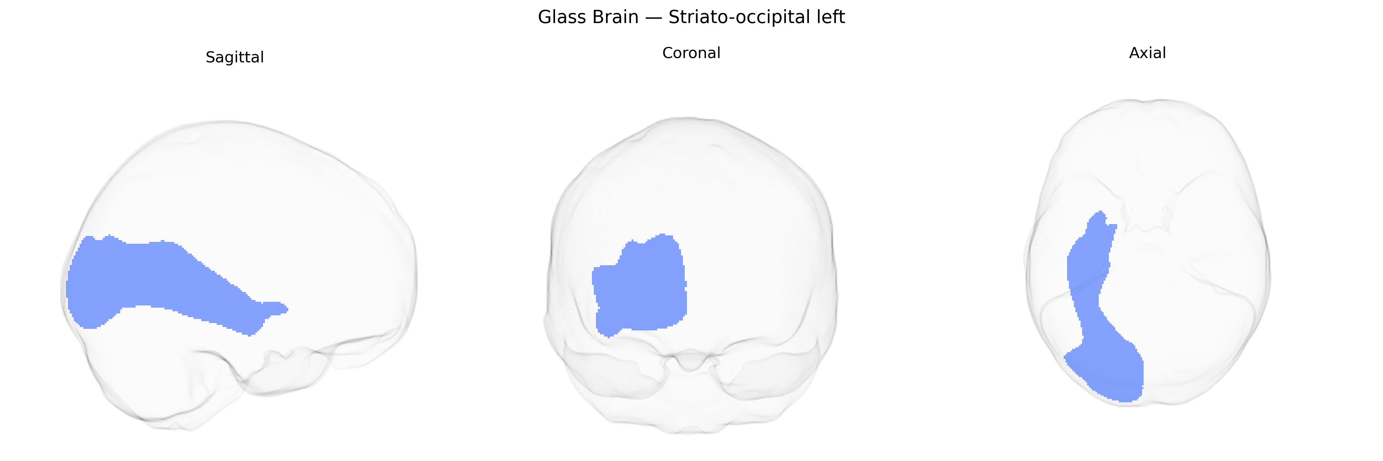 Triplanar Ghost Brain