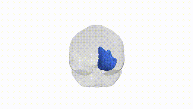 Full Brain White