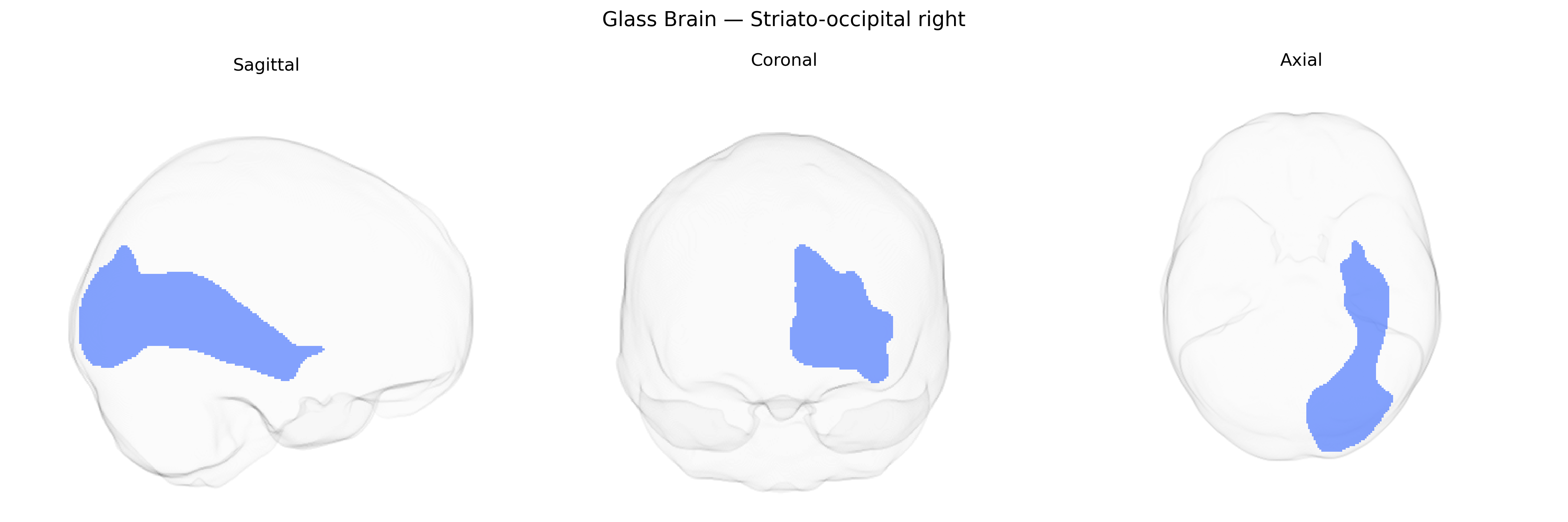 Triplanar Ghost Brain